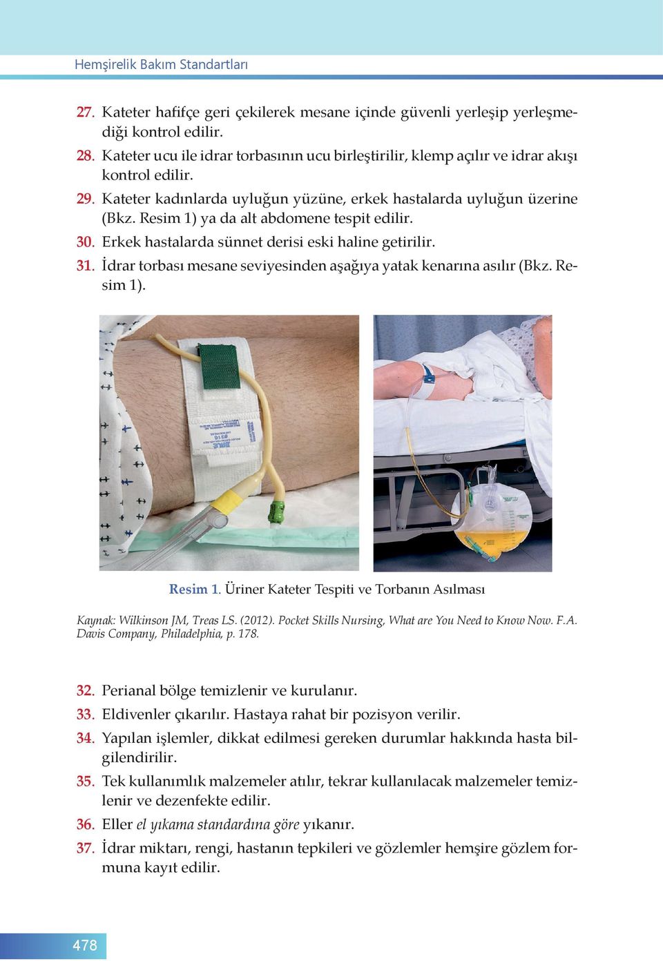 Resim 1) ya da alt abdomene tespit edilir. 30. Erkek hastalarda sünnet derisi eski haline getirilir. 31. İdrar torbası mesane seviyesinden aşağıya yatak kenarına asılır (Bkz. Resim 1)