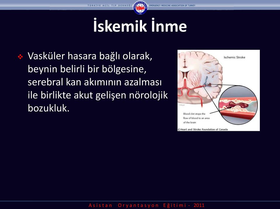 serebral kan akımının azalması ile