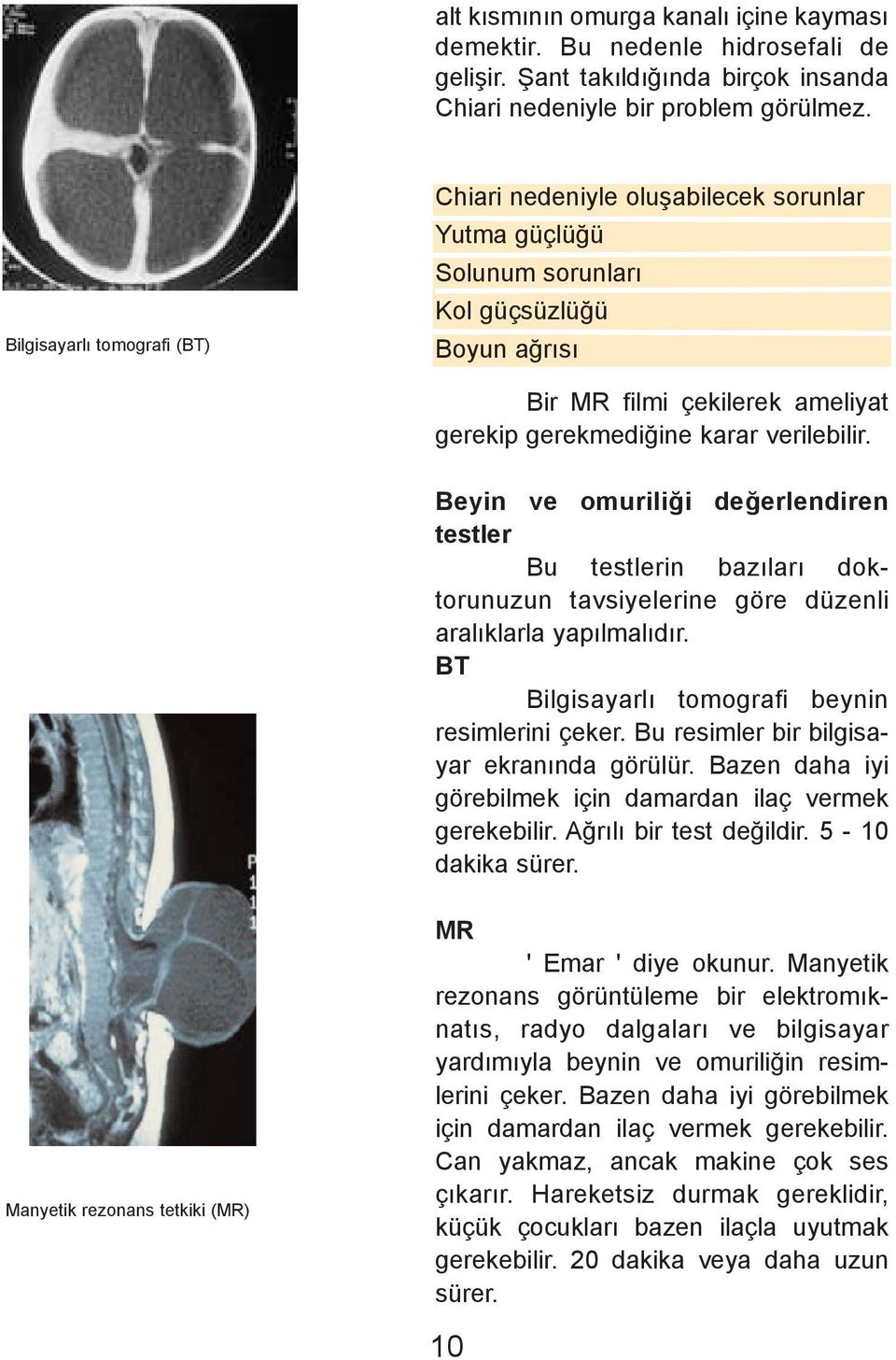 Beyin ve omuriliði deðerlendiren testler Bu testlerin bazýlarý doktorunuzun tavsiyelerine göre düzenli aralýklarla yapýlmalýdýr. BT Bilgisayarlý tomografi beynin resimlerini çeker.