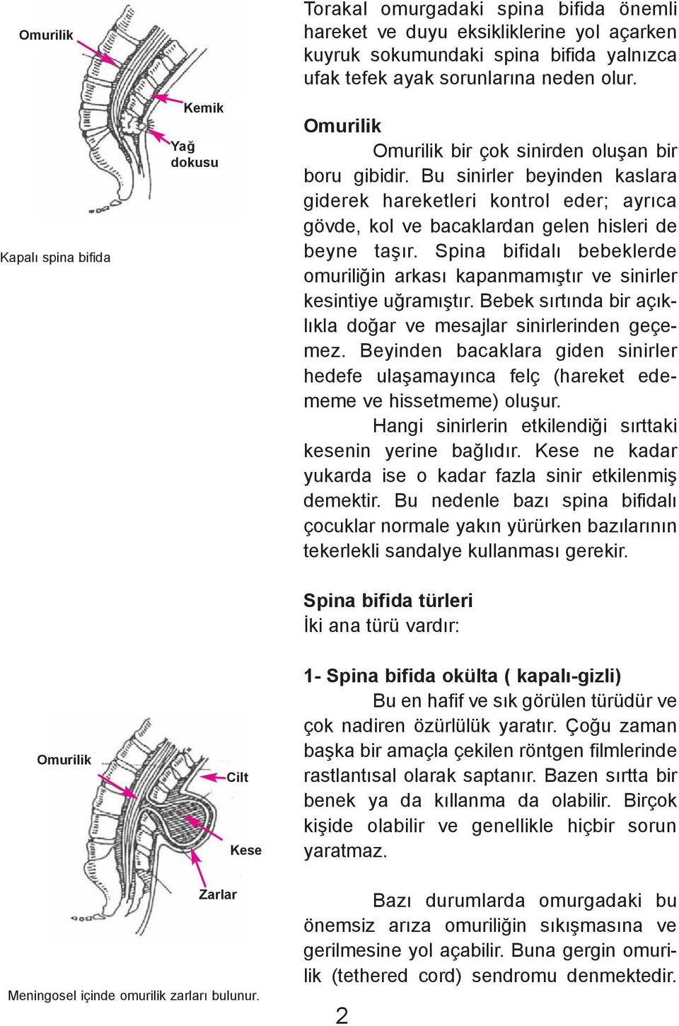 Spina bifidalý bebeklerde omuriliðin arkasý kapanmamýþtýr ve sinirler kesintiye uðramýþtýr. Bebek sýrtýnda bir açýklýkla doðar ve mesajlar sinirlerinden geçemez.