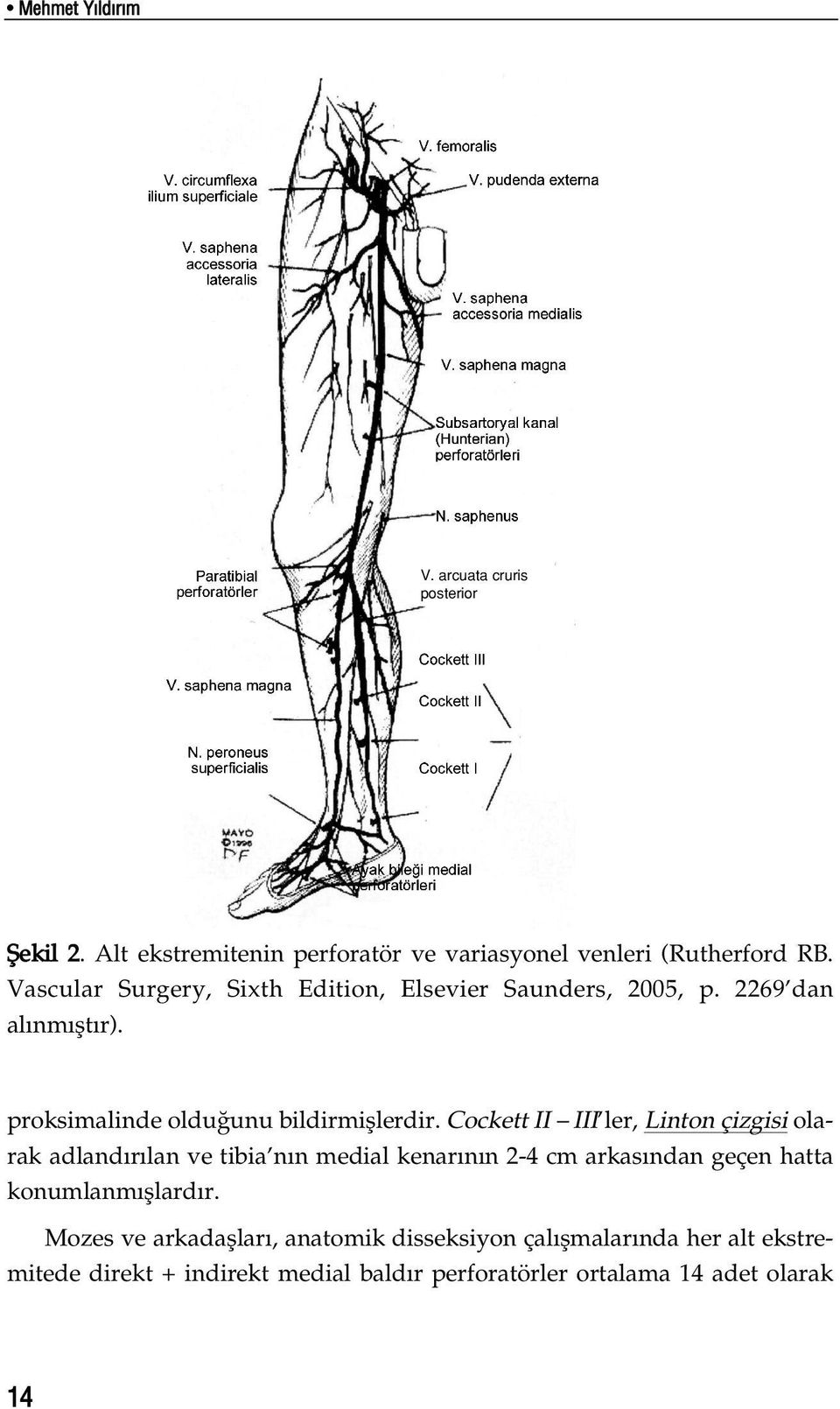 Cockett II III ler, Linton çizgisi olarak adland r lan ve tibia n n medial kenar n n 2-4 cm arkas ndan geçen hatta konumlanm fllard r.