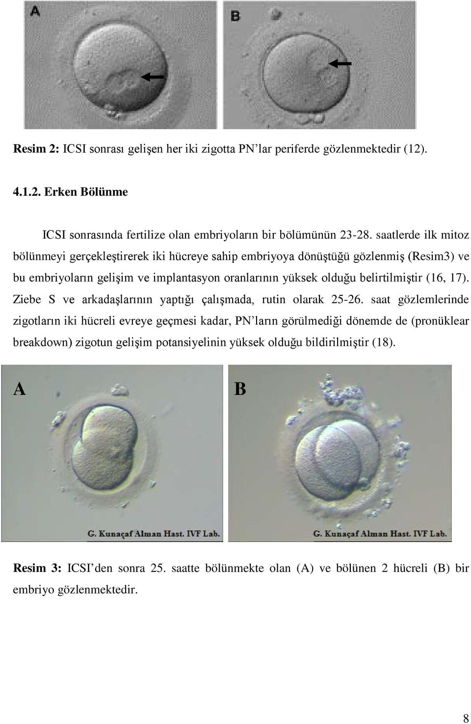 belirtilmiştir (16, 17). Ziebe S ve arkadaşlarının yaptığı çalışmada, rutin olarak 25-26.