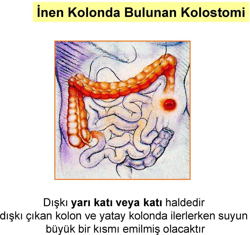 çıkan kolon ve yatay kolonda