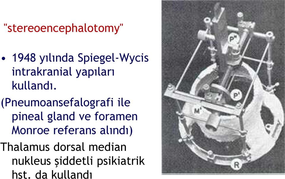 (Pneumoansefalografi ile pineal gland ve foramen Monroe