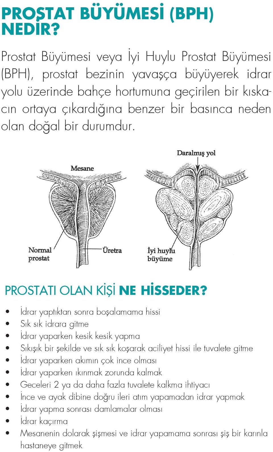 olan doğal bir durumdur. PROSTATI OLAN KİŞİ NE HİSSEDER?