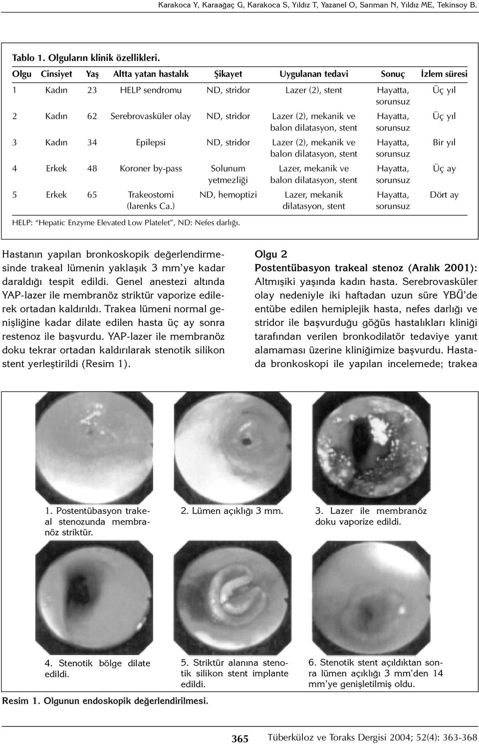 stridor Lazer (2), mekanik ve Hayatta, Üç yıl balon dilatasyon, stent sorunsuz 3 Kadın 34 Epilepsi ND, stridor Lazer (2), mekanik ve Hayatta, Bir yıl balon dilatasyon, stent sorunsuz 4 Erkek 48