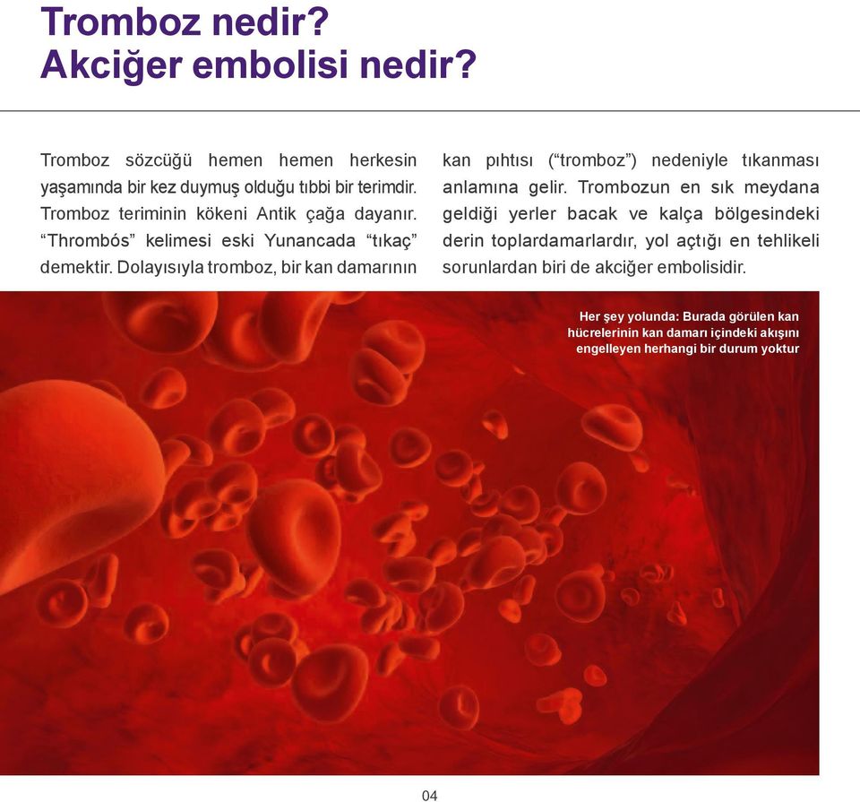 Dolayısıyla tromboz, bir kan damarının kan pıhtısı ( tromboz ) nedeniyle tıkanması anlamına gelir.