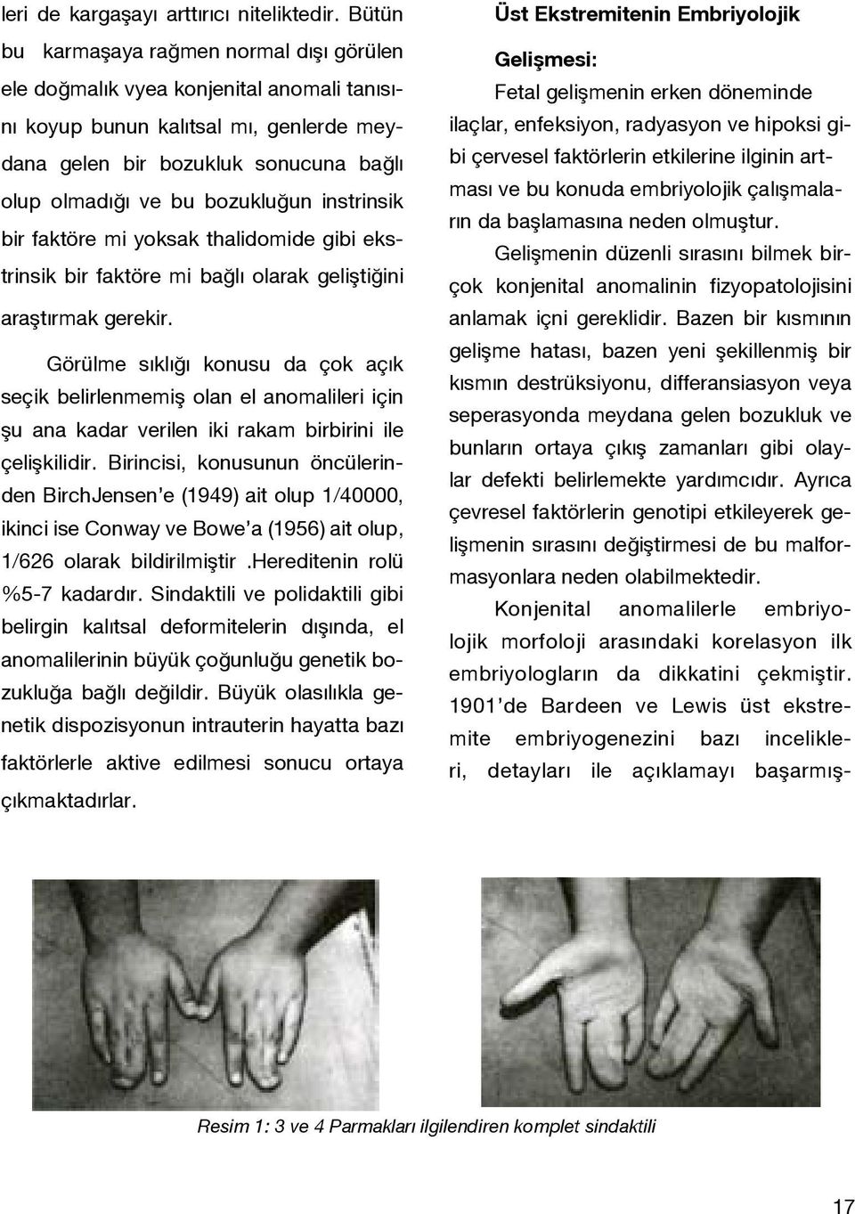 instrinsik bir faktöre mi yoksak thalidomide gibi ekstrinsik bir faktöre mi bağlı olarak geliştiğini araştırmak gerekir.