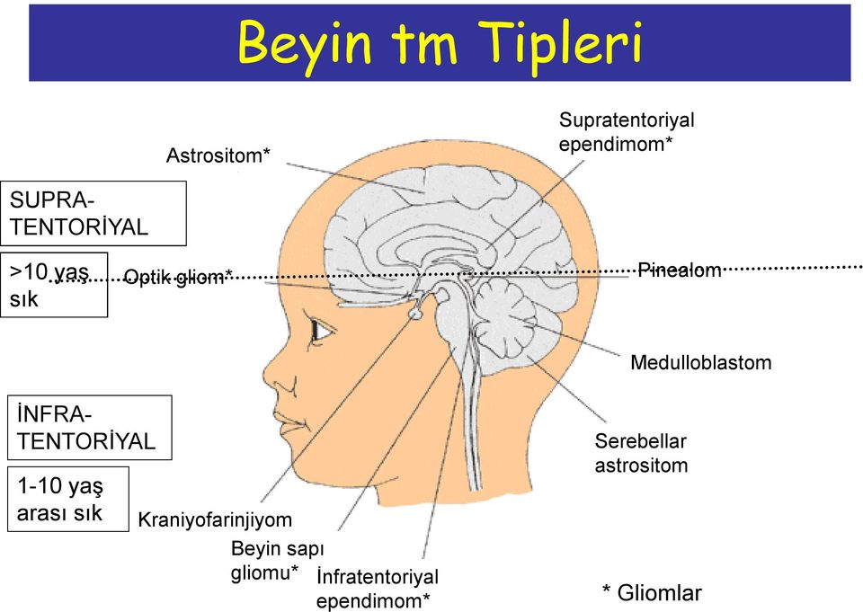 İNFRA- TENTORİYAL 1-10 yaş arası sık Kraniyofarinjiyom Beyin