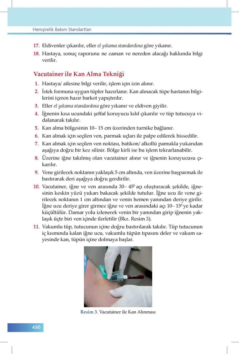 Kan alınacak tüpe hastanın bilgilerini içeren hazır barkot yapıştırılır. 3. Eller el yıkama standardına göre yıkanır ve eldiven giyilir. 4.