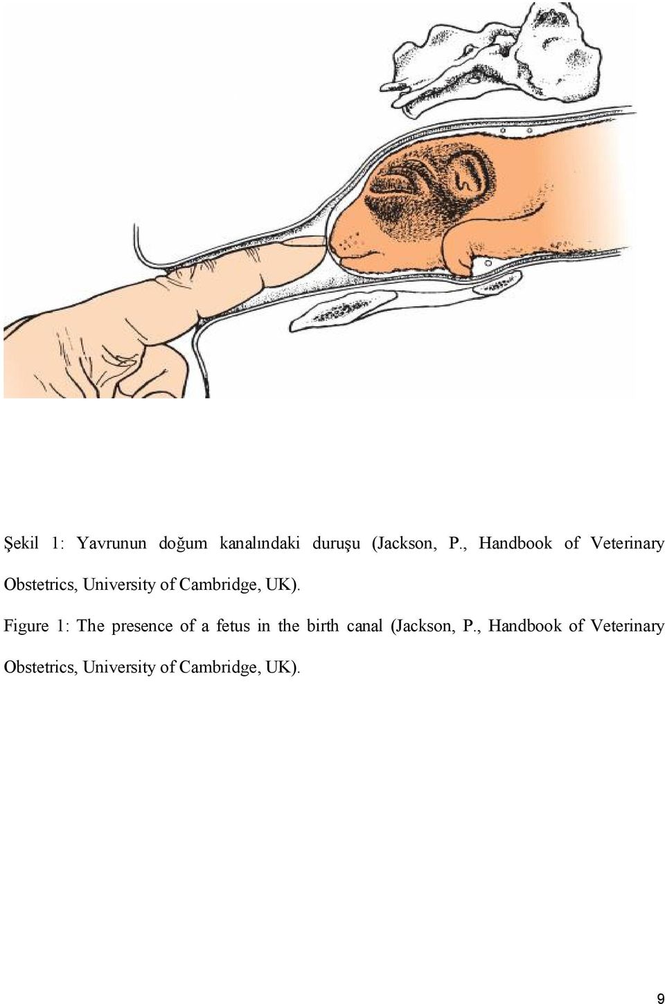 UK). Figure 1: The presence of a fetus in the birth canal