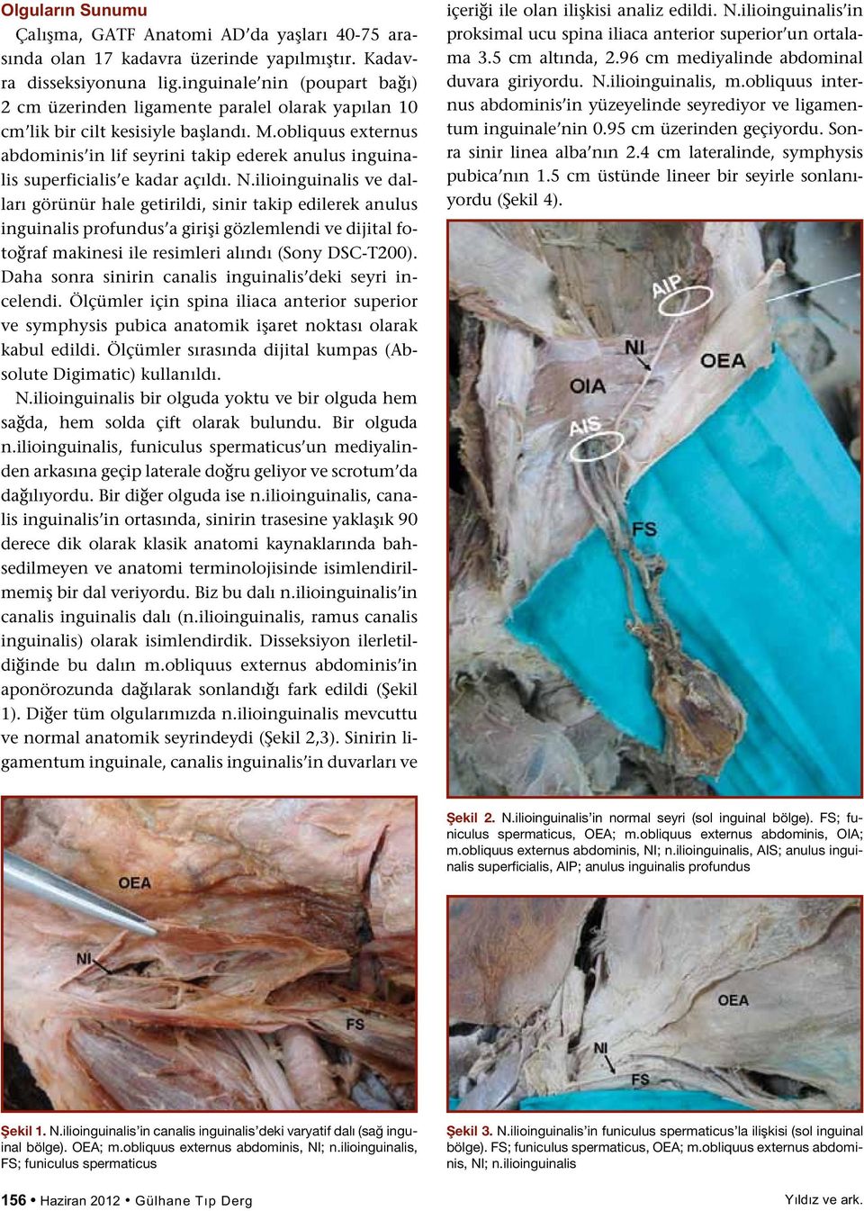 obliquus externus abdominis in lif seyrini takip ederek anulus inguinalis superficialis e kadar açıldı. N.