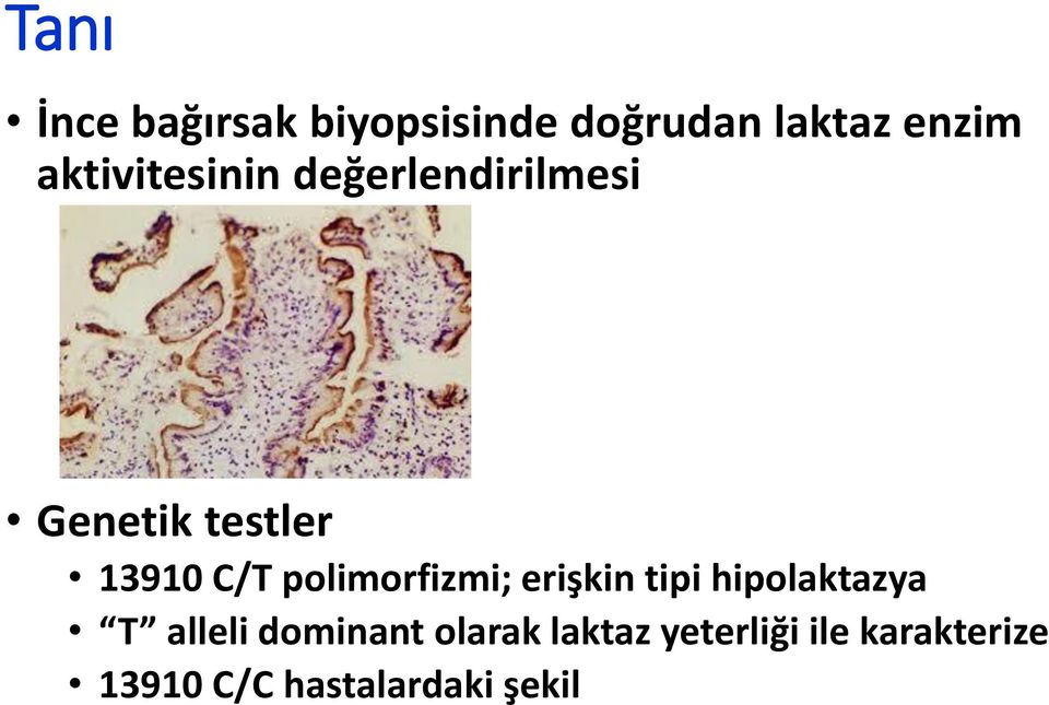 polimorfizmi; erişkin tipi hipolaktazya T alleli dominant