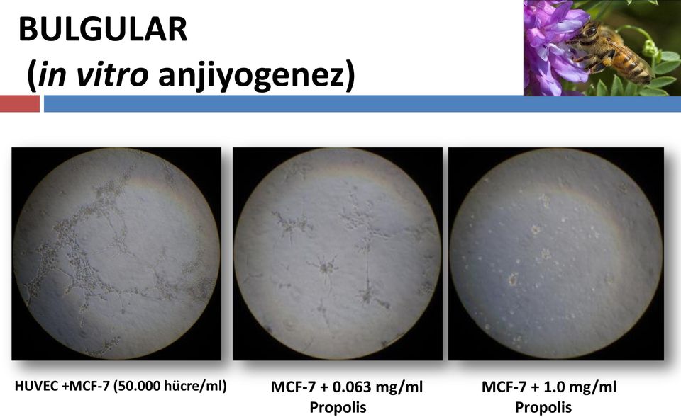 000 hücre/ml) MCF-7 + 0.