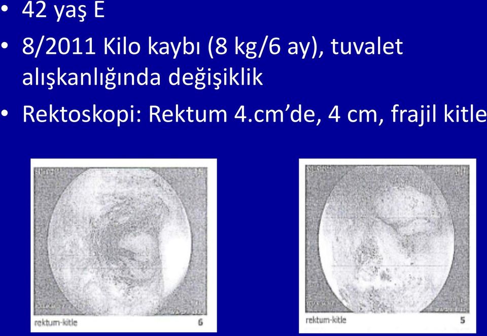 alışkanlığında değişiklik