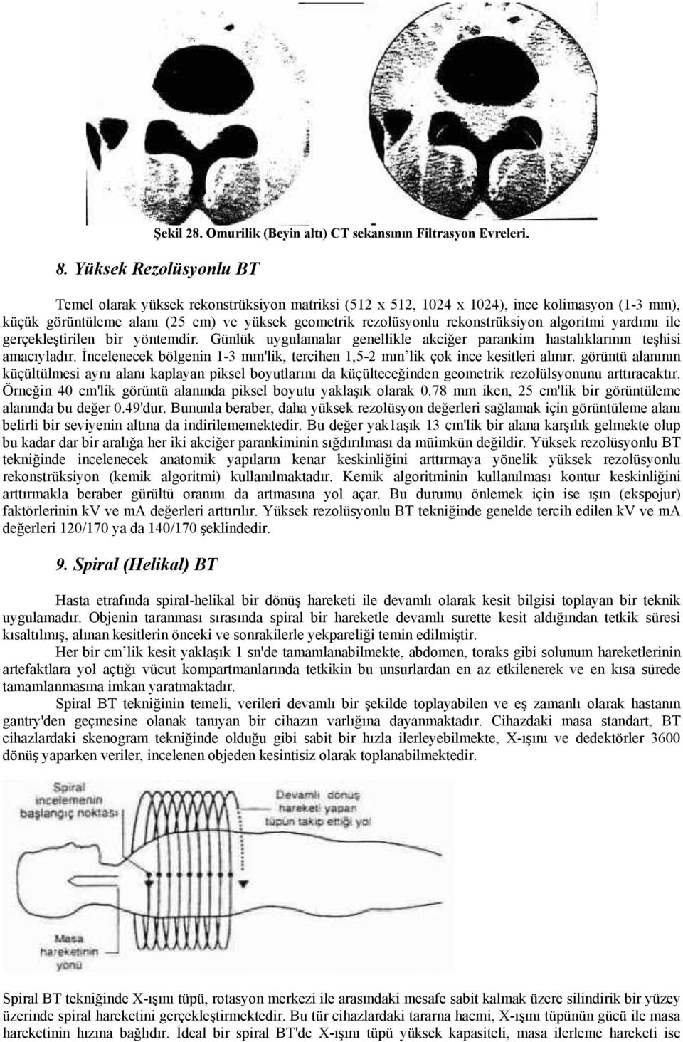 rekonstrüksiyon algoritmi yardımı ile gerçekleştirilen bir yöntemdir. Günlük uygulamalar genellikle akciğer parankim hastalıklarının teşhisi amacıyladır.