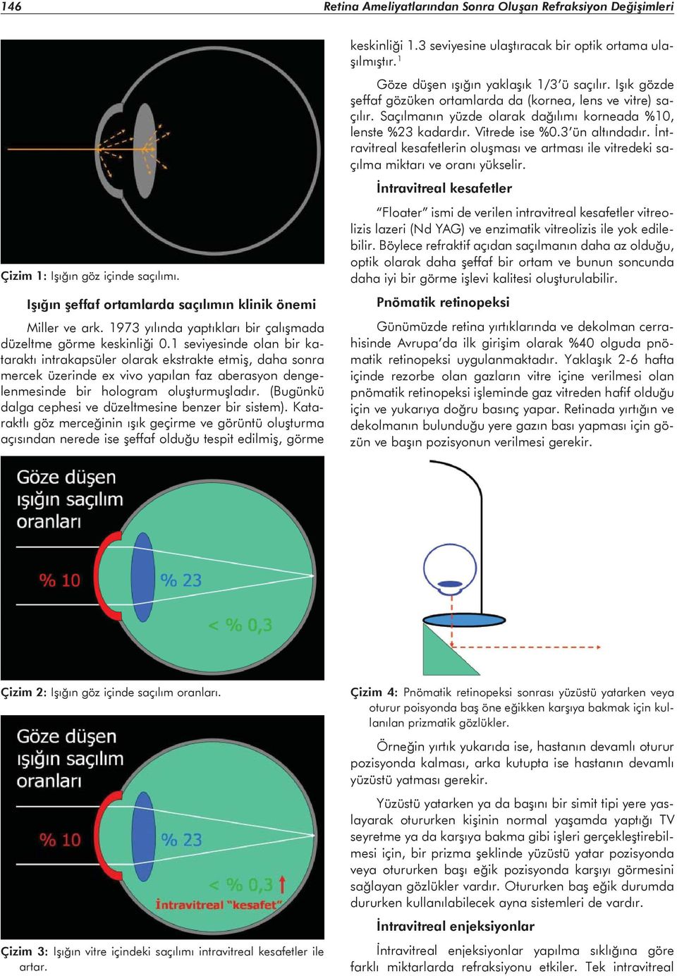 1 seviyesinde olan bir kataraktı intrakapsüler olarak ekstrakte etmiş, daha sonra mercek üzerinde ex vivo yapılan faz aberasyon dengelenmesinde bir hologram oluşturmuşladır.