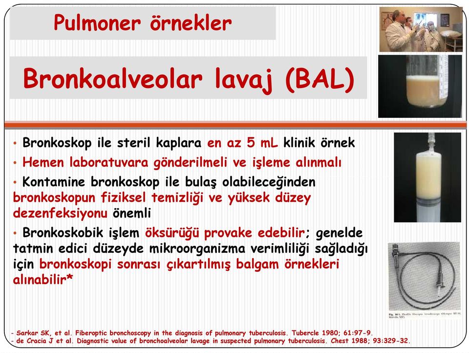 edici düzeyde mikroorganizma verimliliği sağladığı için bronkoskopi sonrası çıkartılmış balgam örnekleri alınabilir* - Sarkar SK, et al.