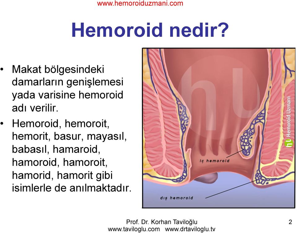 hemoroid adı verilir.