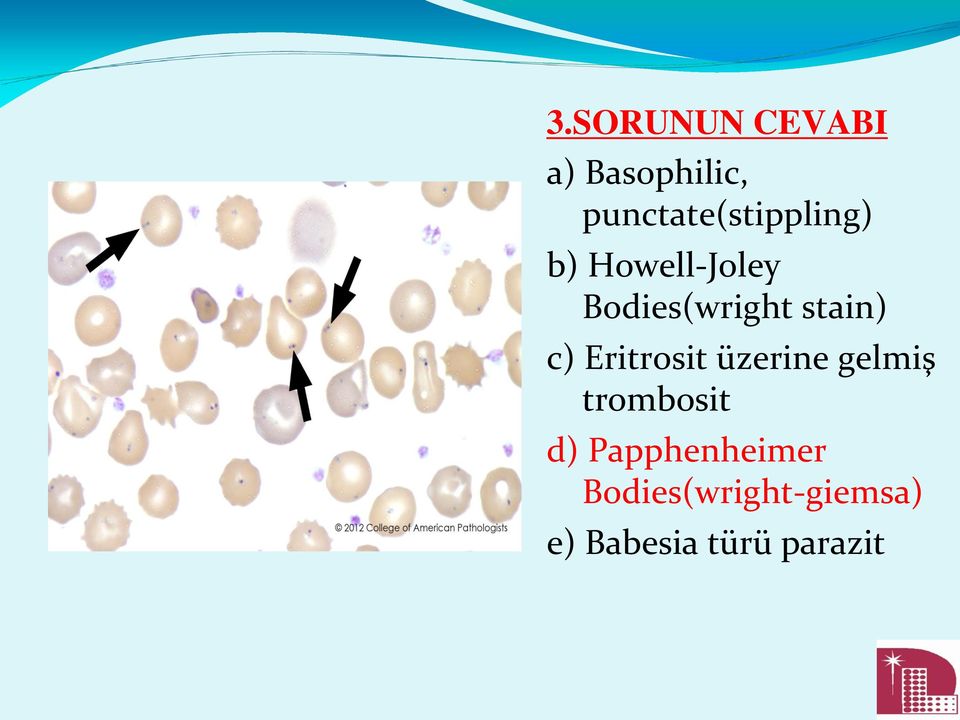 Bodies(wright stain) c) Eritrosit üzerine