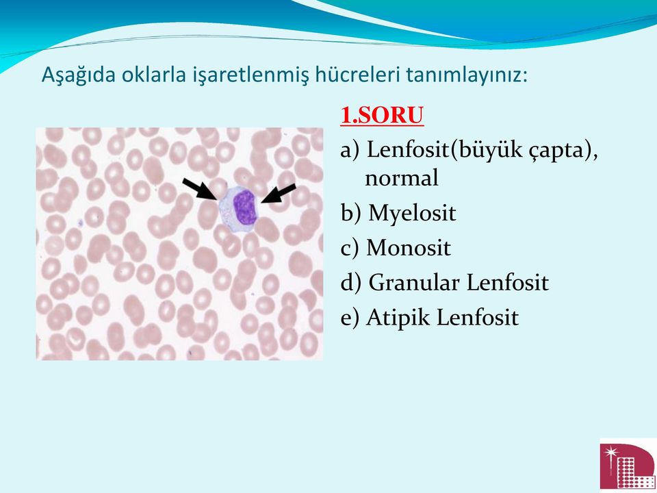 SORU a) Lenfosit(büyük çapta), normal