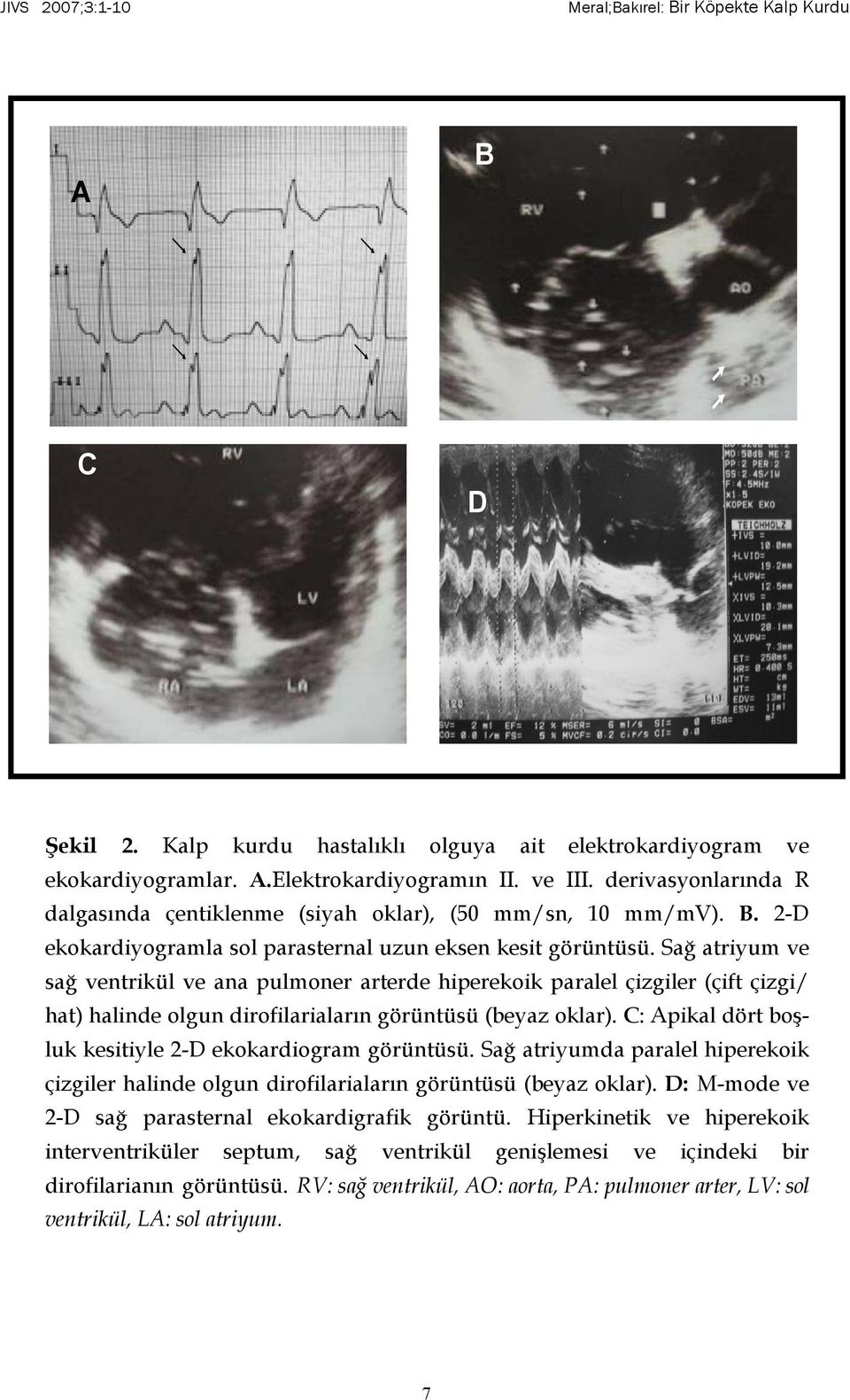 Sağ atriyum ve sağ ventrikül ve ana pulmoner arterde hiperekoik paralel çizgiler (çift çizgi/ hat) halinde olgun dirofilariaların görüntüsü (beyaz oklar).