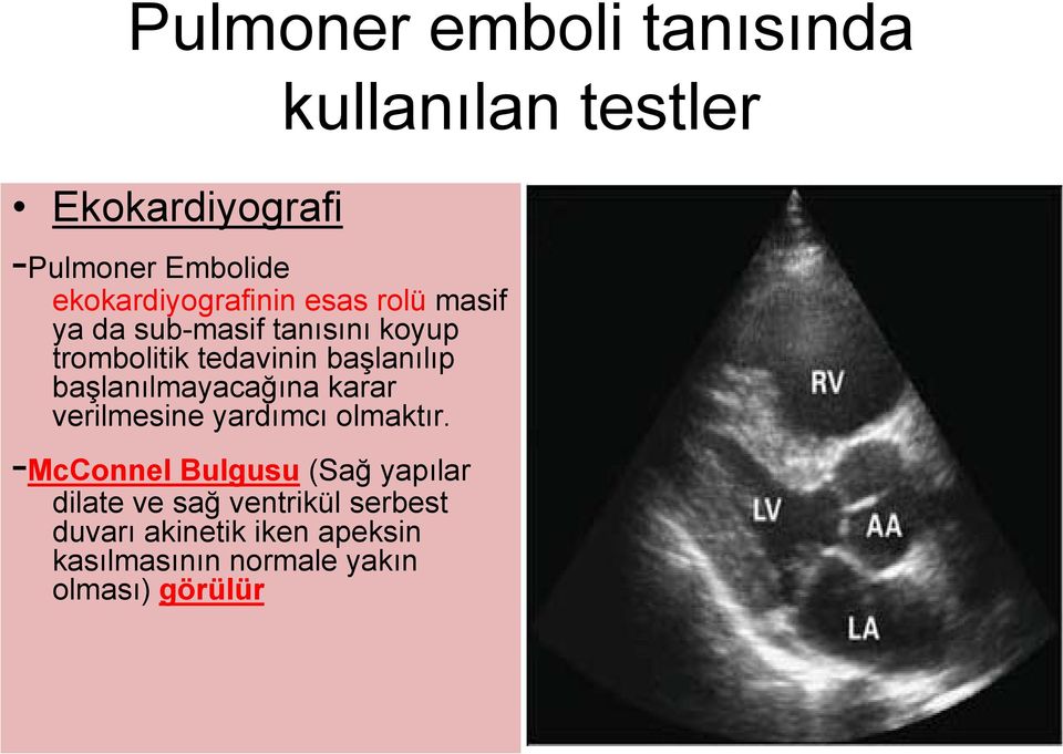 karar verilmesine yardımcı olmaktır.