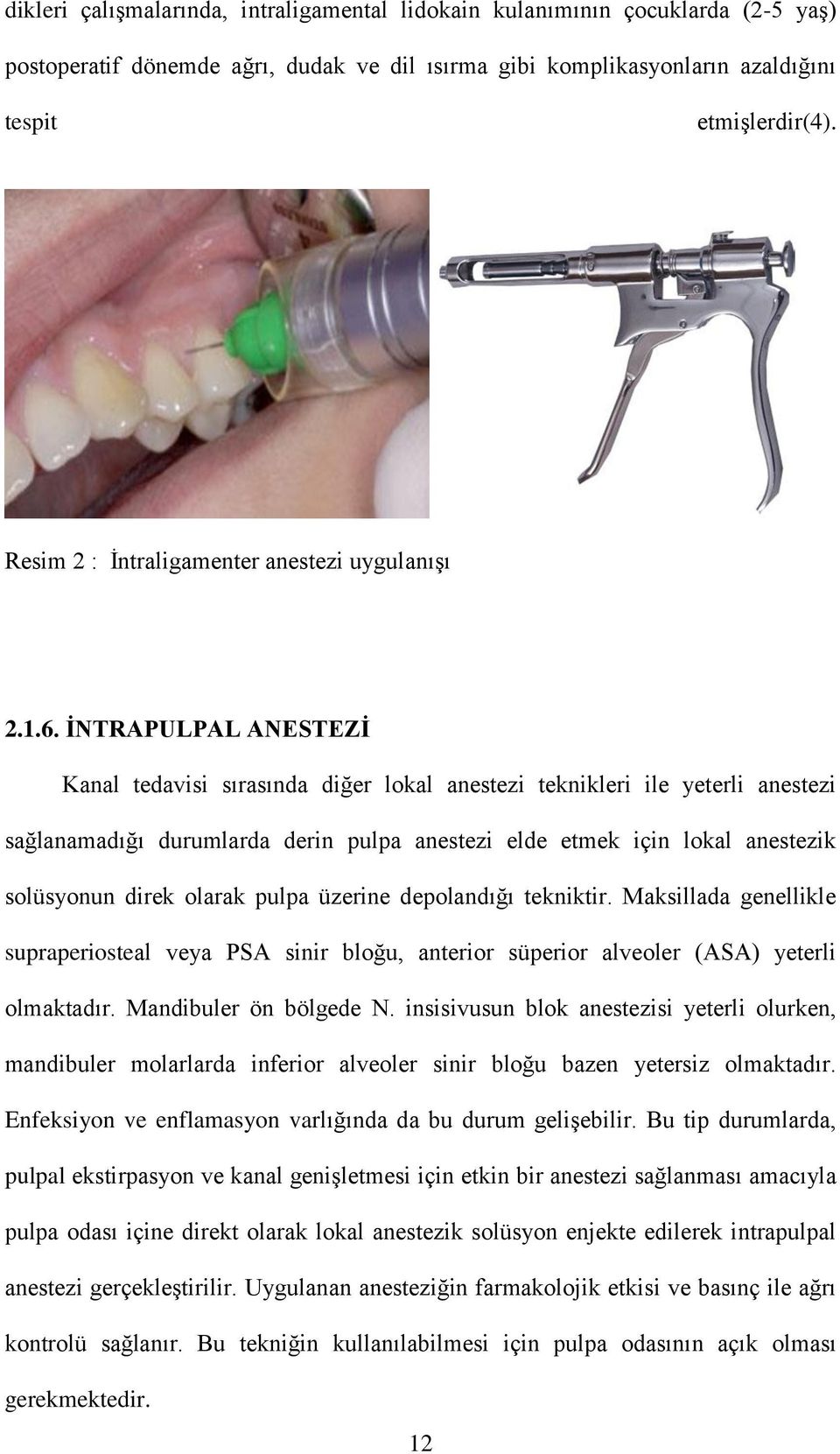 İNTRAPULPAL ANESTEZİ Kanal tedavisi sırasında diğer lokal anestezi teknikleri ile yeterli anestezi sağlanamadığı durumlarda derin pulpa anestezi elde etmek için lokal anestezik solüsyonun direk