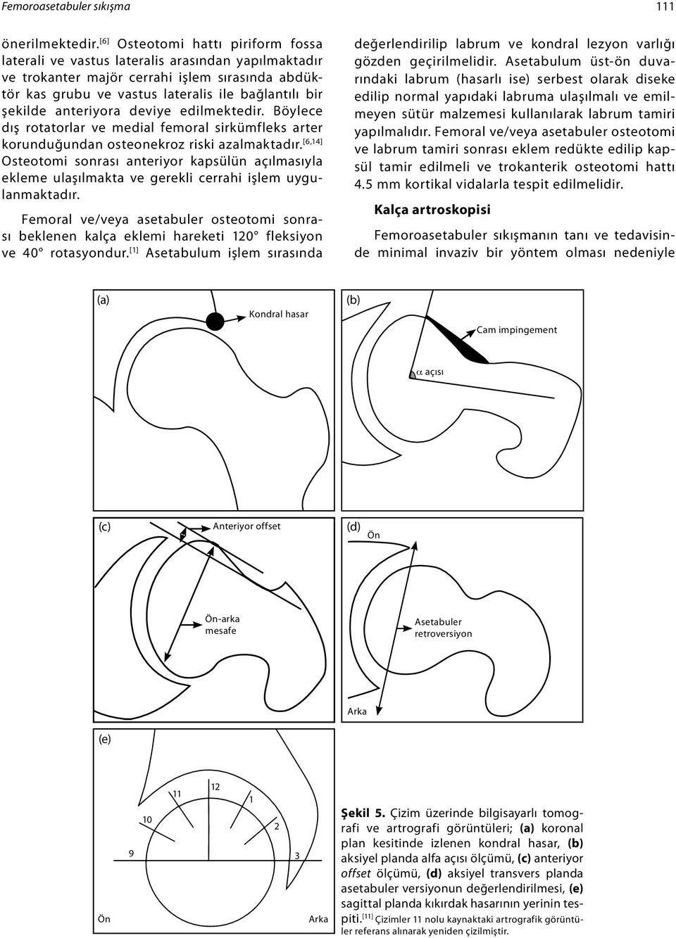 anteriyora deviye edilmektedir. Böylece dış rotatorlar ve medial femoral sirkümfleks arter korunduğundan osteonekroz riski azalmaktadır.