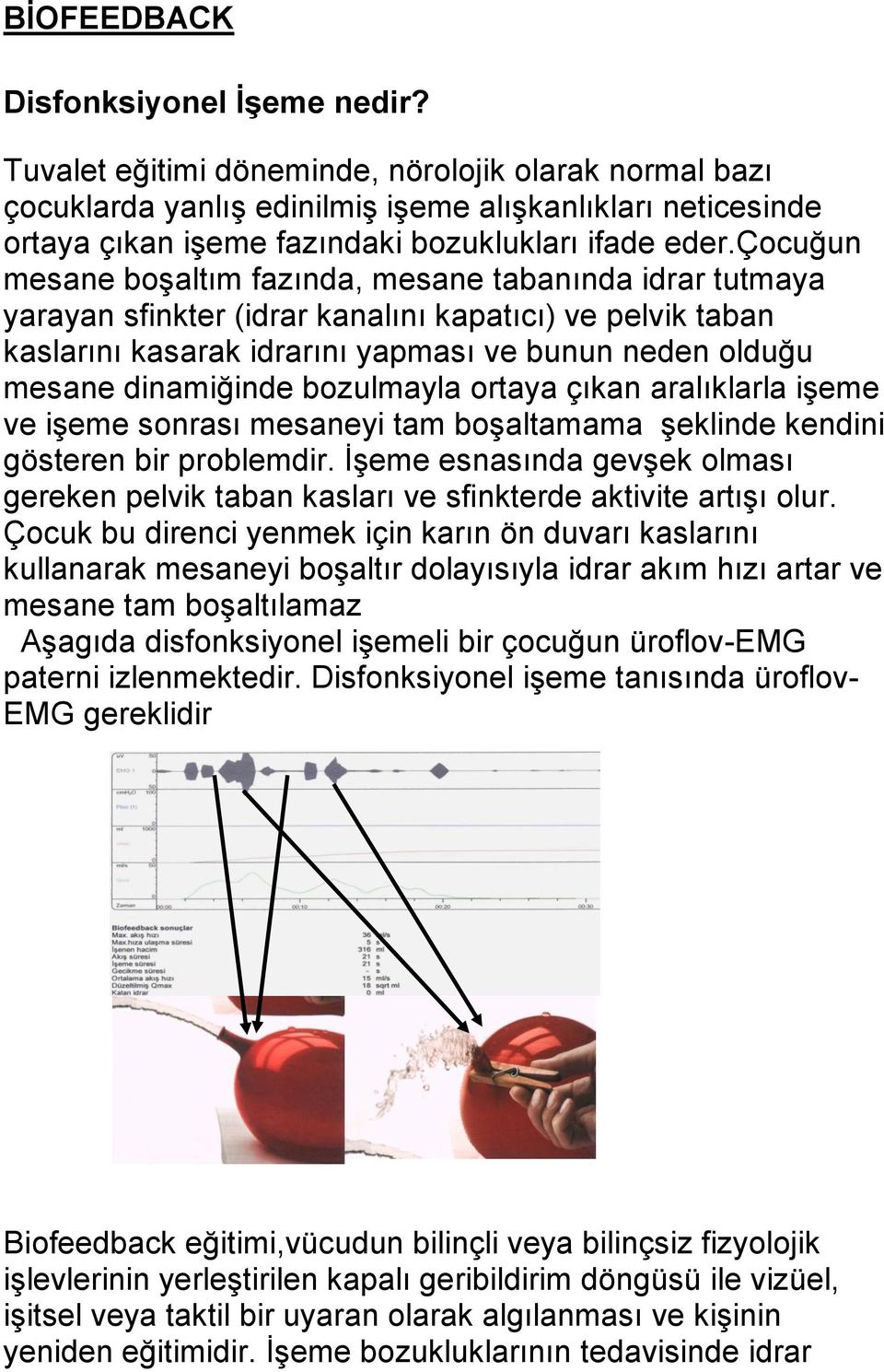 çocuğun mesane boşaltım fazında, mesane tabanında idrar tutmaya yarayan sfinkter (idrar kanalını kapatıcı) ve pelvik taban kaslarını kasarak idrarını yapması ve bunun neden olduğu mesane dinamiğinde