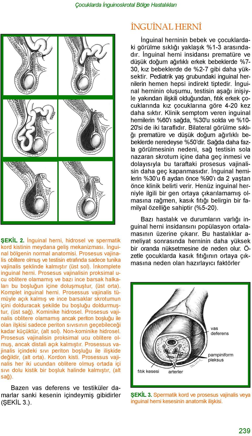 Prosesus vajinalisin proksimal u- cu oblitere olamamış ve bazı ince barsak halkaları bu boşluğun içine doluşmuştur, (üst orta). Komplet inguinal herni.