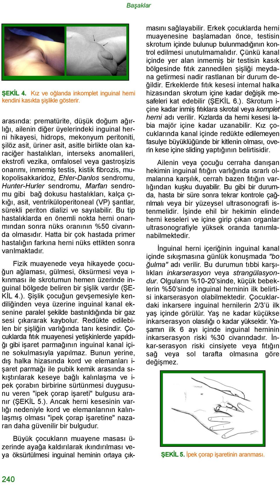 interseks anomalileri, ekstrofi vezika, omfalosel veya gastroşizis onarımı, inmemiş testis, kistik fibrozis, mukopolisakkaridoz, Ehler-Danlos sendromu, Hunter-Hurler sendromu, Marfan sendromu gibi