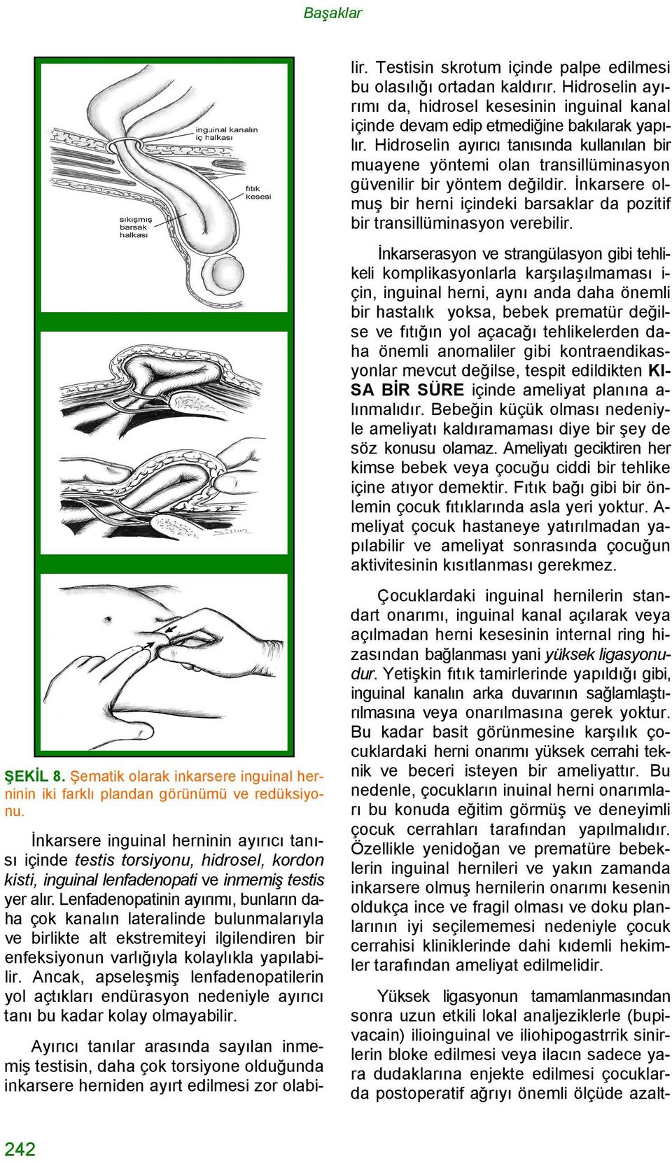 Lenfadenopatinin ayırımı, bunların daha çok kanalın lateralinde bulunmalarıyla ve birlikte alt ekstremiteyi ilgilendiren bir enfeksiyonun varlığıyla kolaylıkla yapılabilir.