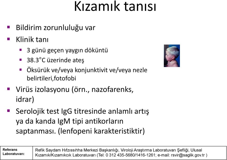 , nazofarenks, idrar) Serolojik test IgG titresinde anlamlı artış ya da kanda IgM tipi antikorların saptanması.