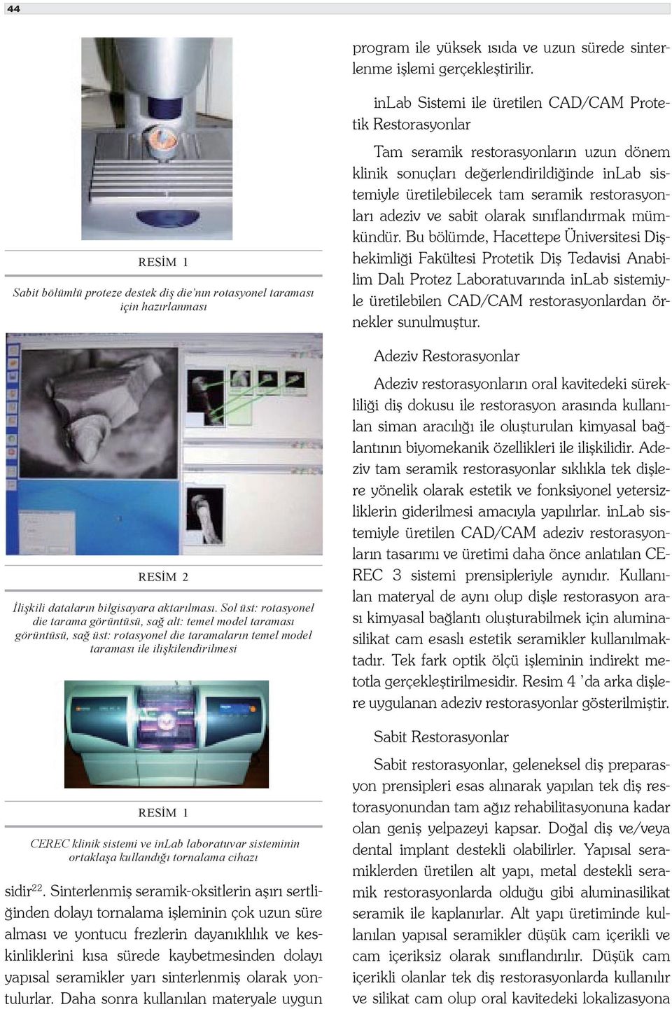 Sol üst: rotasyonel die tarama görüntüsü, sağ alt: temel model taraması görüntüsü, sağ üst: rotasyonel die taramaların temel model taraması ile ilişkilendirilmesi RESİM 1 CEREC klinik sistemi ve