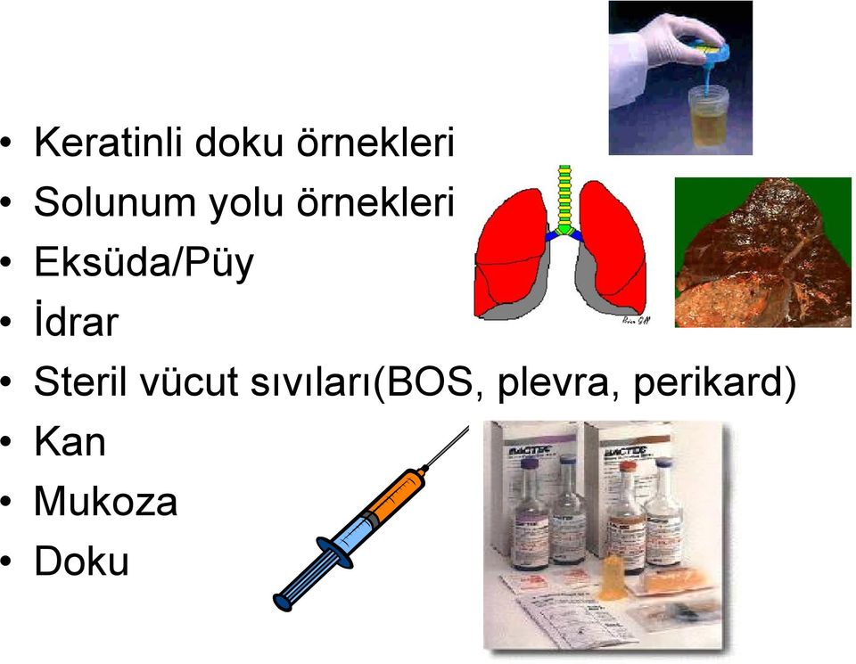 Eksüda/Püy İdrar Steril vücut