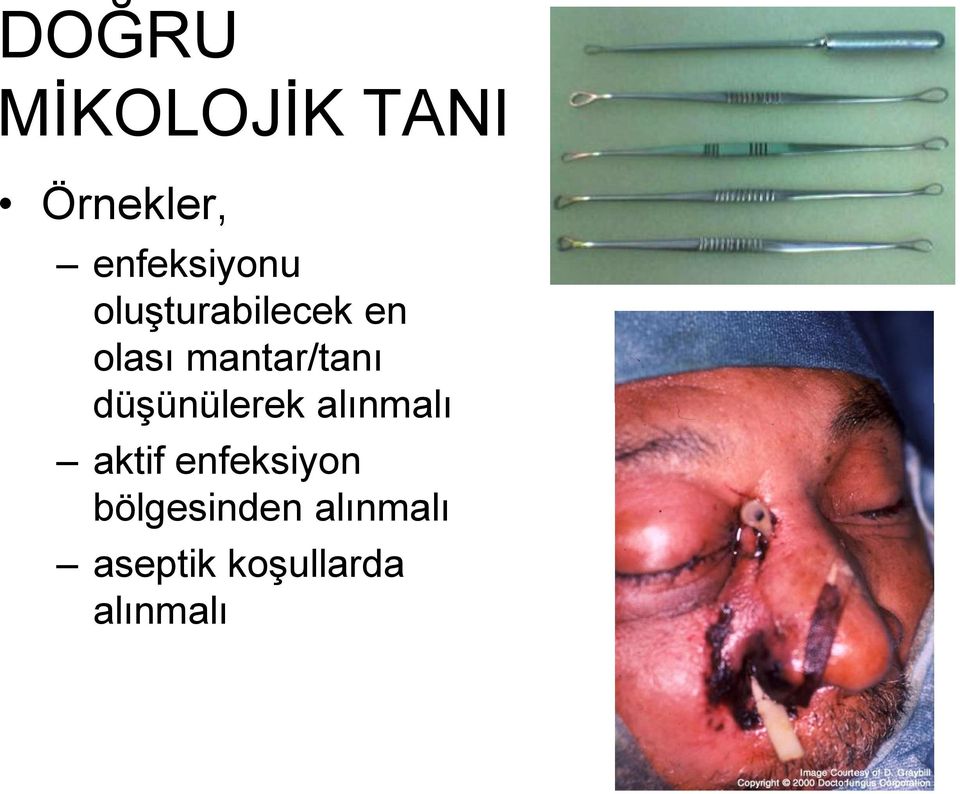 mantar/tanı düşünülerek alınmalı aktif