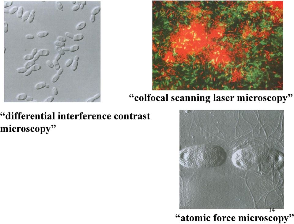 colfocal scanning laser