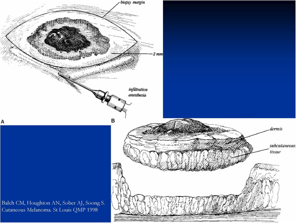 S. Cutaneous