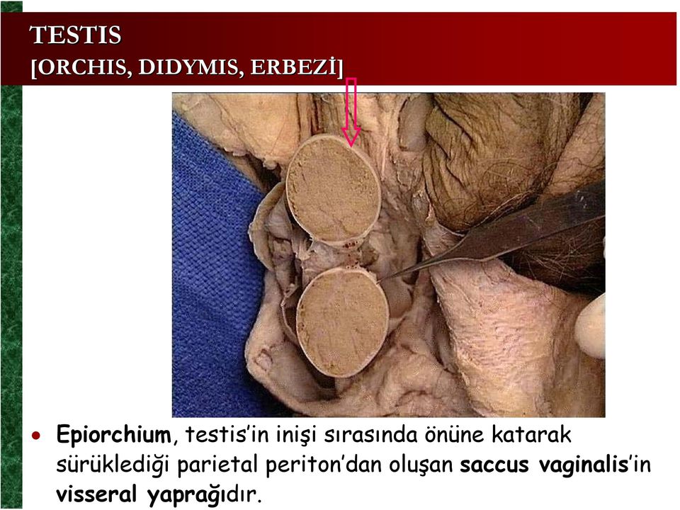 periton dan oluşan saccus vaginalis in