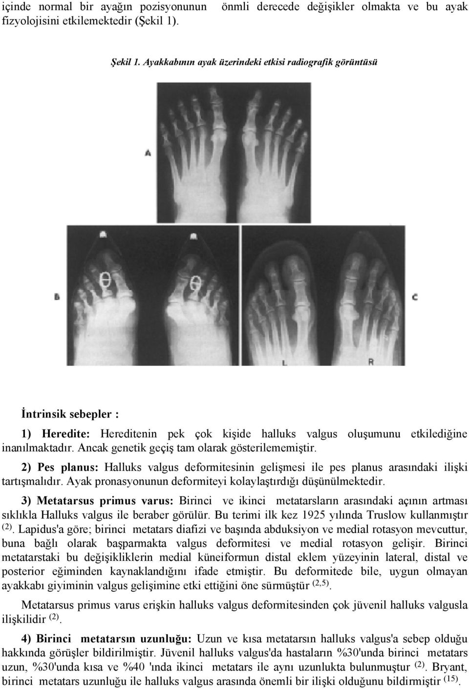 Ancak genetik geçiş tam olarak gösterilememiştir. 2) Pes planus: Halluks valgus deformitesinin gelişmesi ile pes planus arasındaki ilişki tartışmalıdır.