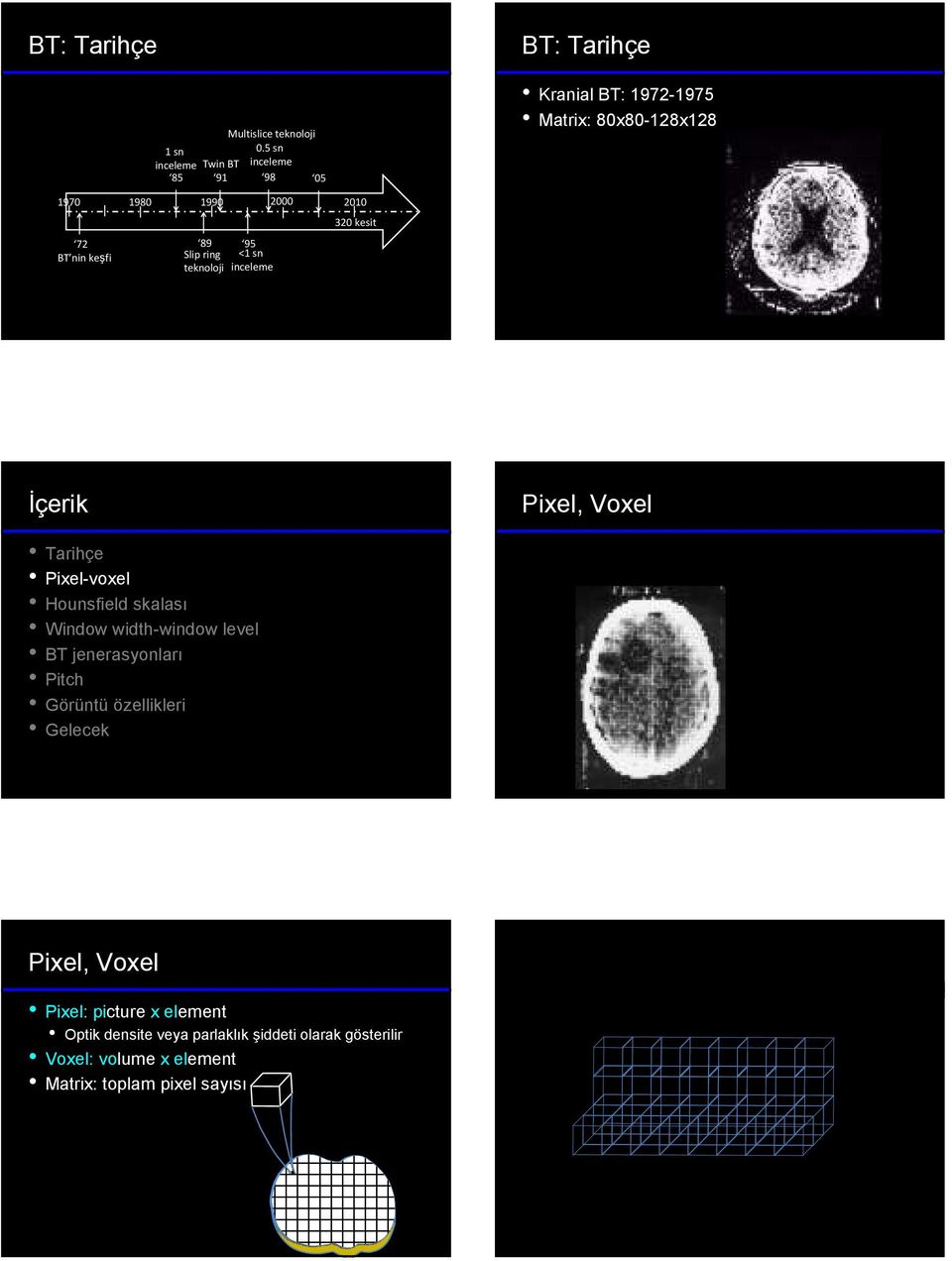 2010 320 kesit Kranial BT: 1972-1975 Matrix: 80x80-128x128 Pixel, Voxel Pixel, Voxel Pixel: