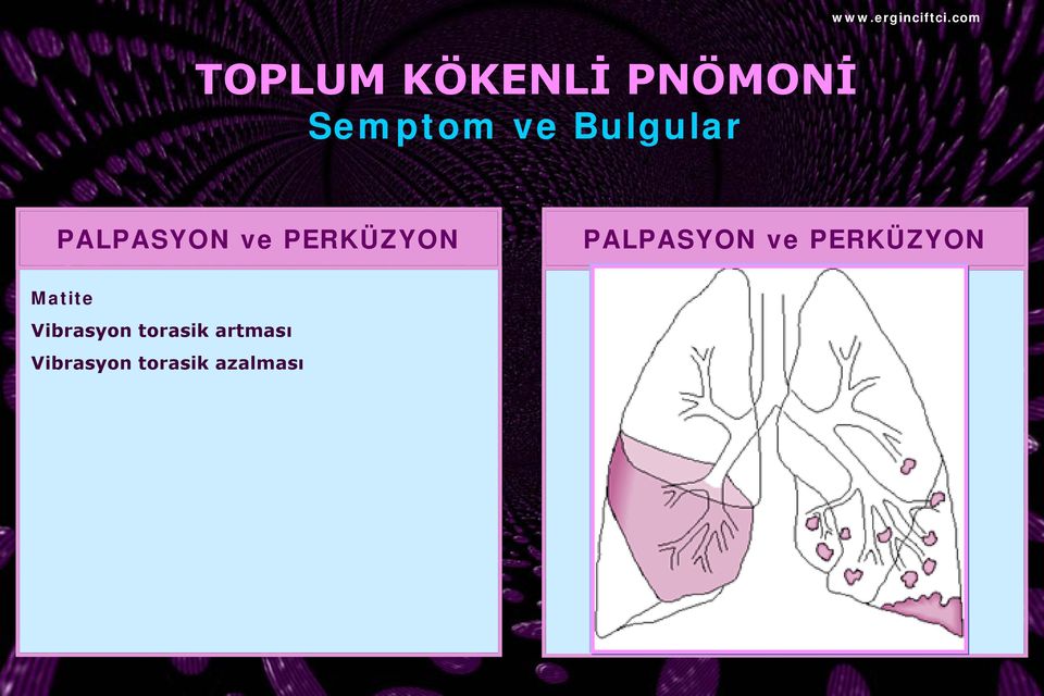 PERKÜZYON Matite Vibrasyon