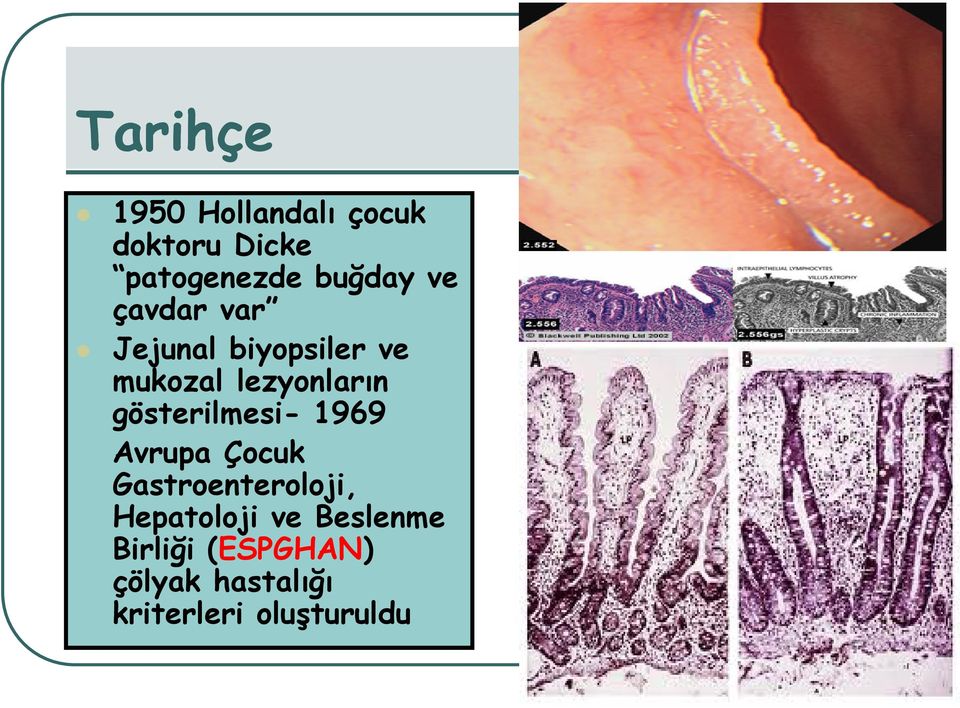 gösterilmesi- 1969 Avrupa Çocuk Gastroenteroloji, Hepatoloji