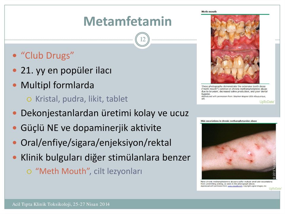 likit, tablet Dekonjestanlardan üretimi kolay ve ucuz Güçlü NE ve