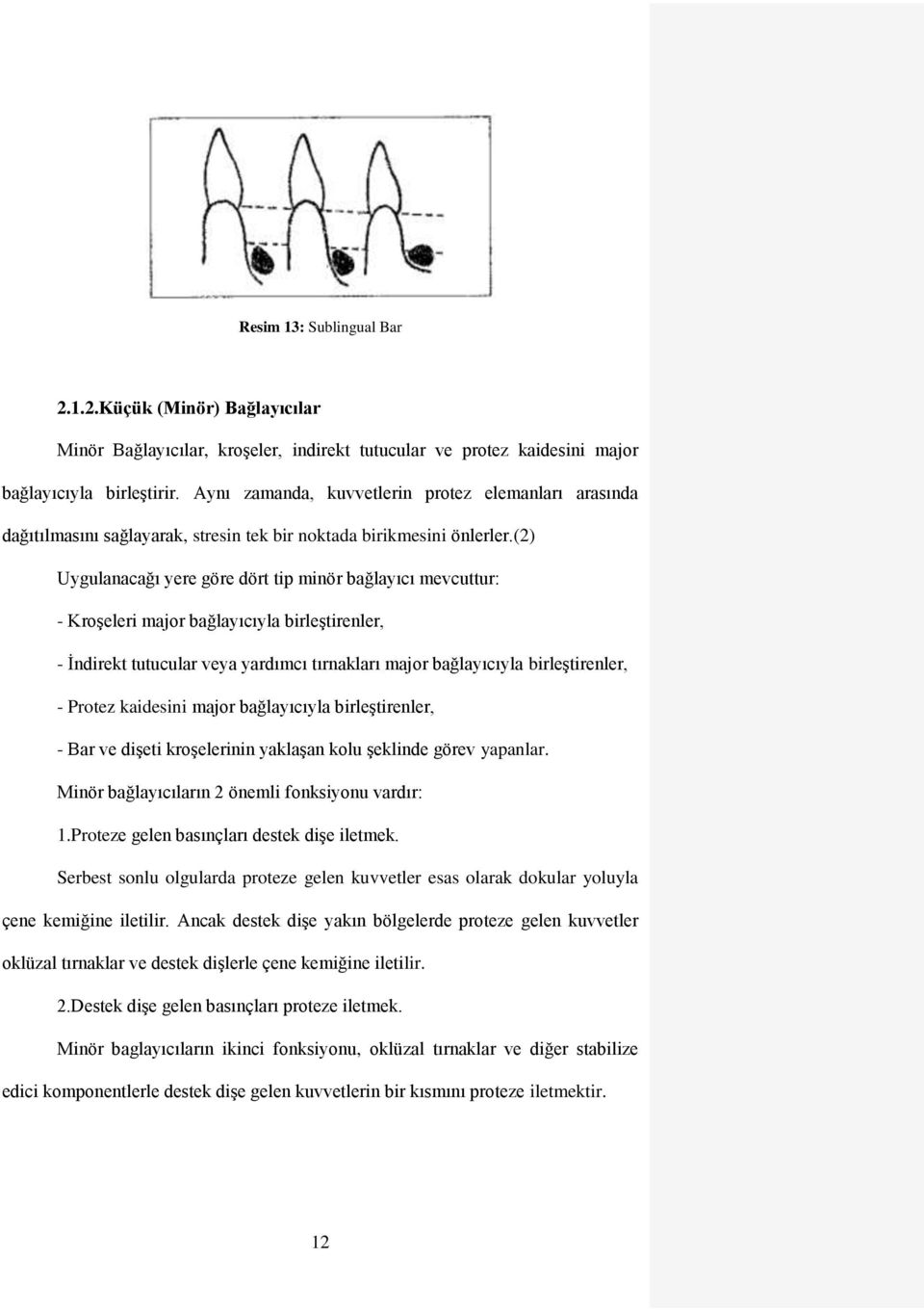 (2) Uygulanacağı yere göre dört tip minör bağlayıcı mevcuttur: - Kroşeleri major bağlayıcıyla birleştirenler, - İndirekt tutucular veya yardımcı tırnakları major bağlayıcıyla birleştirenler, - Protez