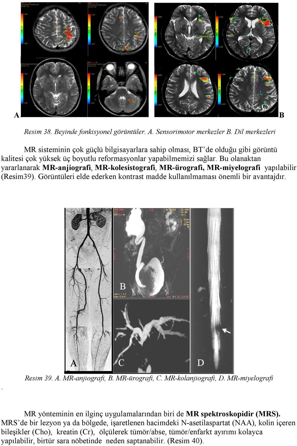 Bu olanaktan yararlanarak MR-anjiografi, MR-kolesistografi, MR-ürografi, MR-miyelografi yapılabilir (Resim39). Görüntüleri elde ederken kontrast madde kullanılmaması önemli bir avantajdır.. Resim 39.