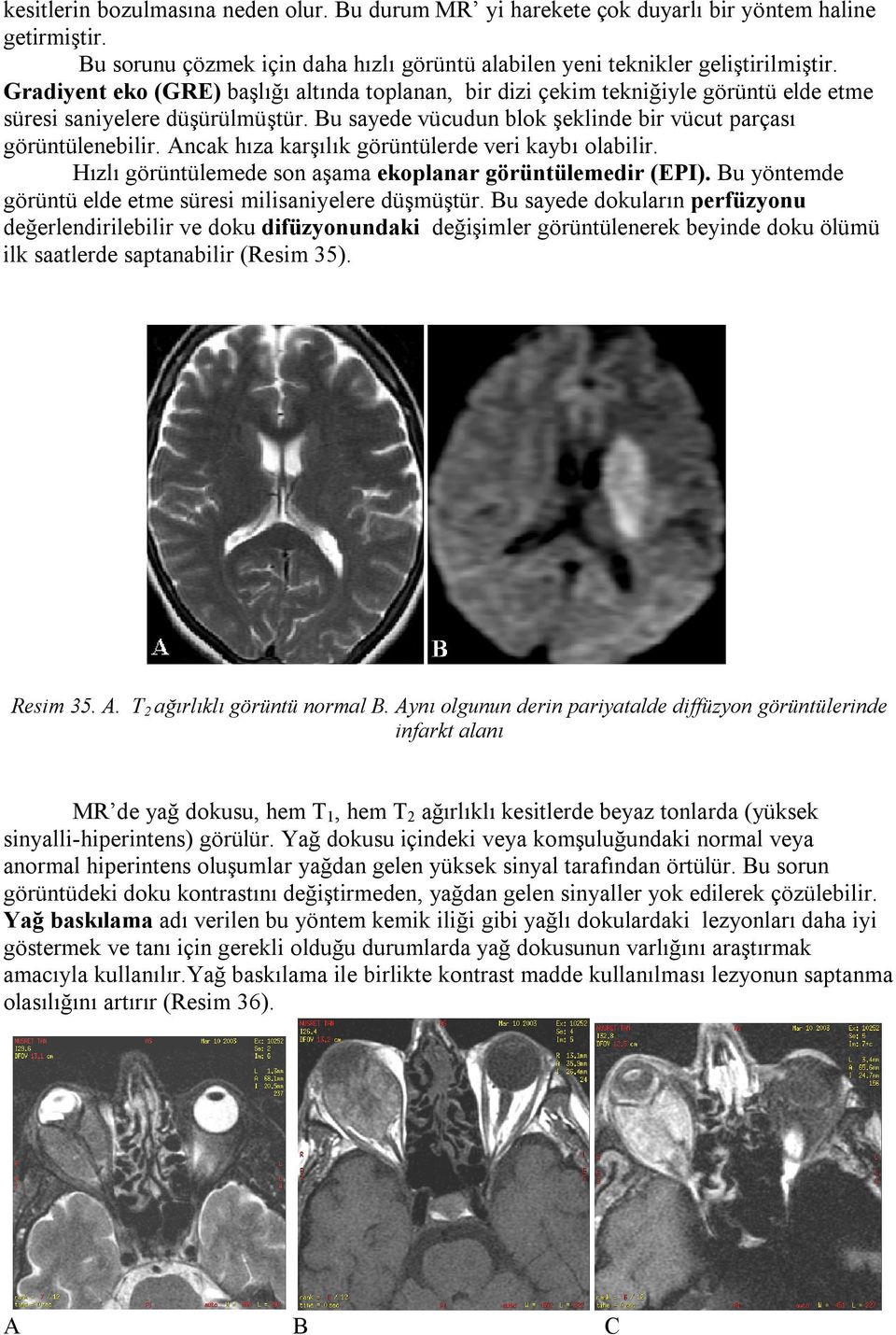 Ancak hıza karşılık görüntülerde veri kaybı olabilir. Hızlı görüntülemede son aşama ekoplanar görüntülemedir (EPI). Bu yöntemde görüntü elde etme süresi milisaniyelere düşmüştür.