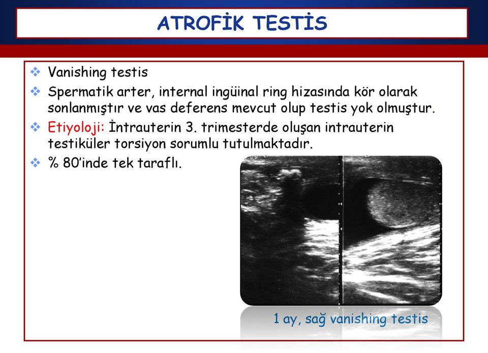 olmuştur. Etiyoloji: İntrauterin 3.