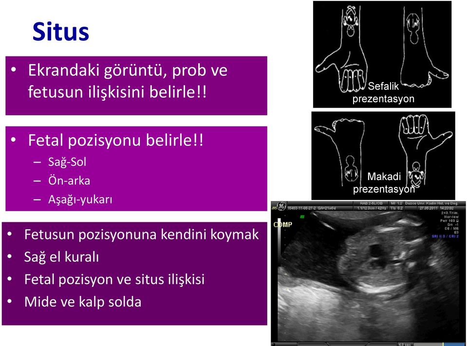 ! Sağ-Sol Ön-arka Aşağı-yukarı Makadi prezentasyon Fetusun